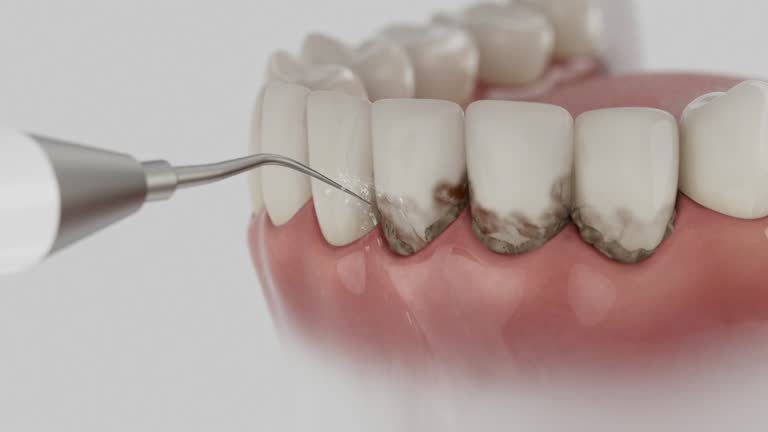 Trusted Tooth Extraction service in McFarland, CA - Dentist Open Now